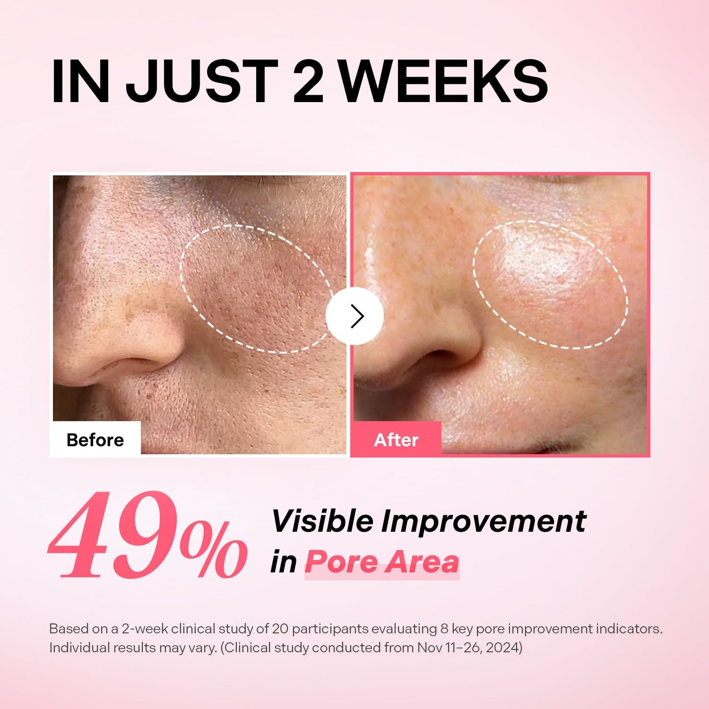 Torriden CELLMAZING Pore Perfecting Ampoule 30ml