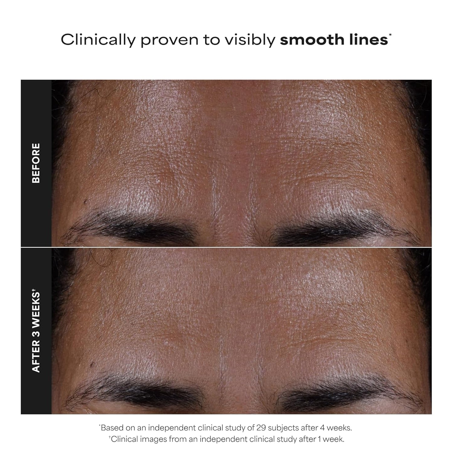 Paula's Choice SKIN PERFECTING 2% BHA Liquid